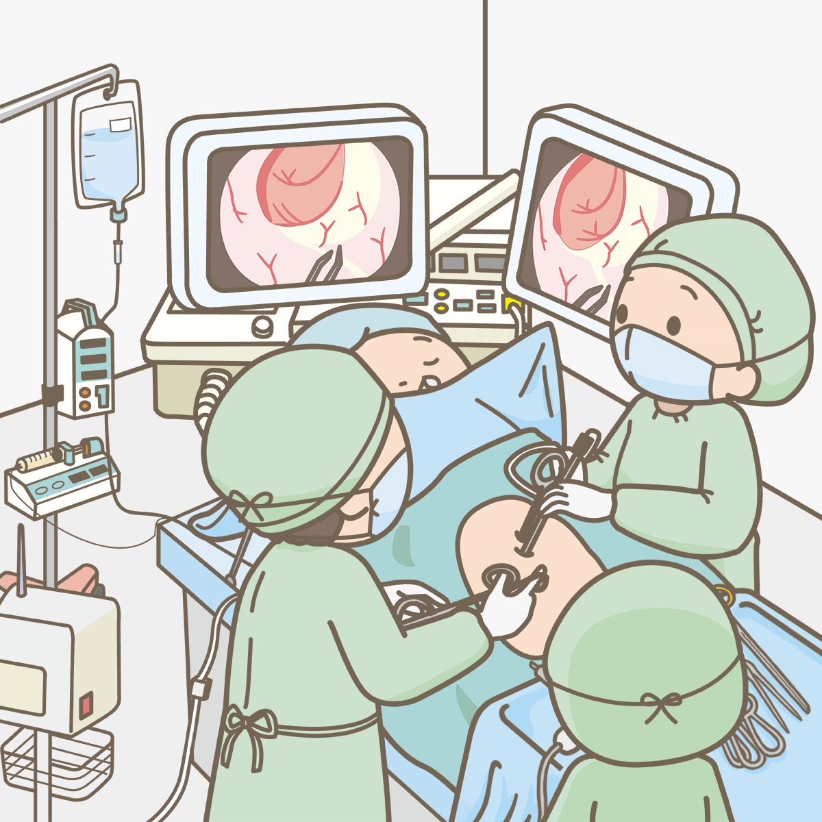腹腔鏡手術 腹腔鏡手術