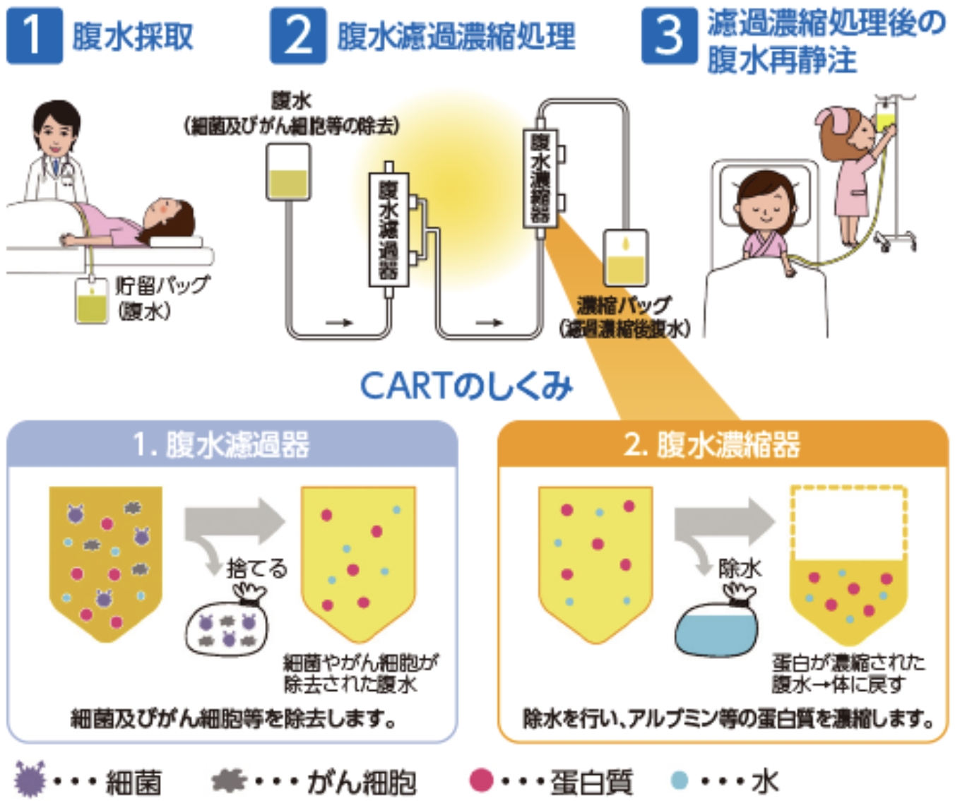 がん性腹膜炎に伴う腹水の治療