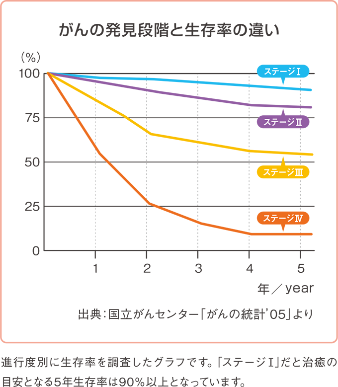 がんの発見段階と生存率の違い