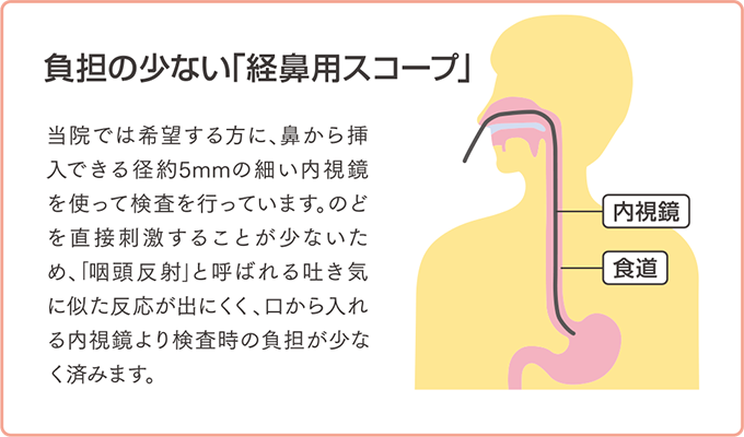 負担の少ない「経鼻用スコープ」