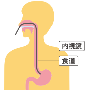 経鼻用スコープ図